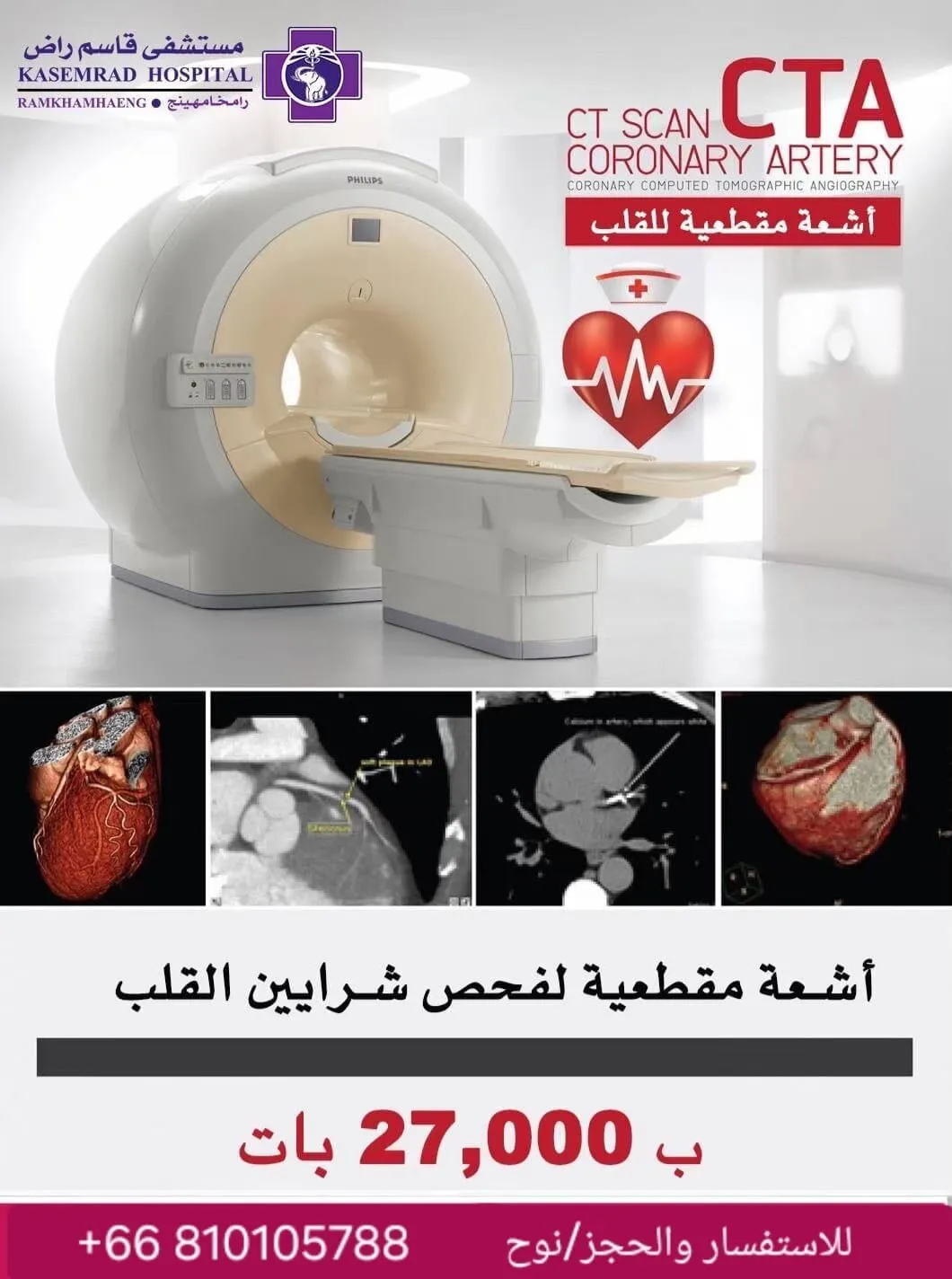 أشعة مقطعية لفحص شرايين القلب (CTA)